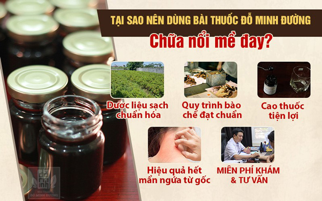 Nổi mề đay là gì? Nguyên nhân, triệu chứng và cách điều trị bệnh hiệu quả - 4