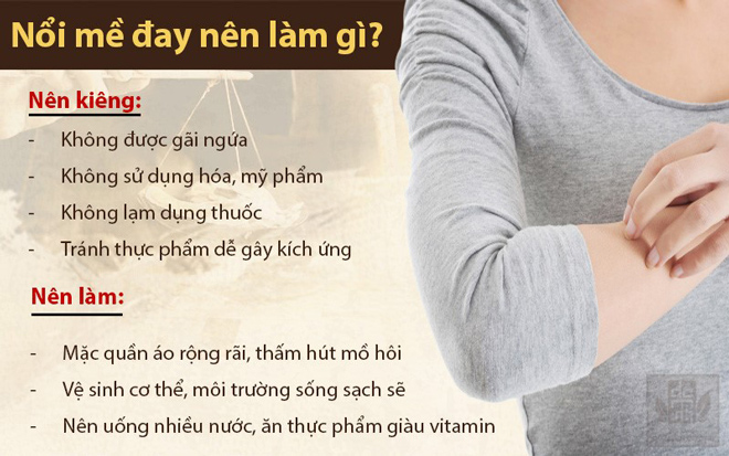 Nổi mề đay là gì? Nguyên nhân, triệu chứng và cách điều trị bệnh hiệu quả - 5