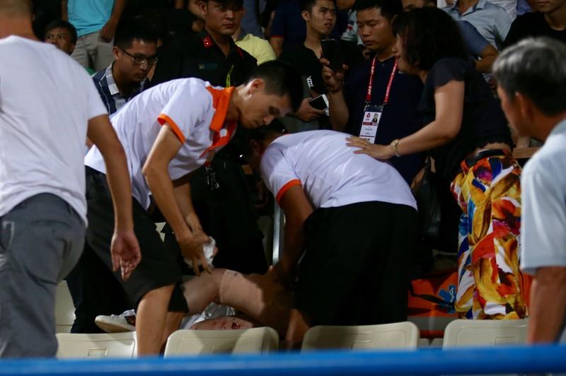 Một cổ động viên nữ
không may bị trúng pháo sang ngay phần đùi khiến máu chảy đầm
đìa.