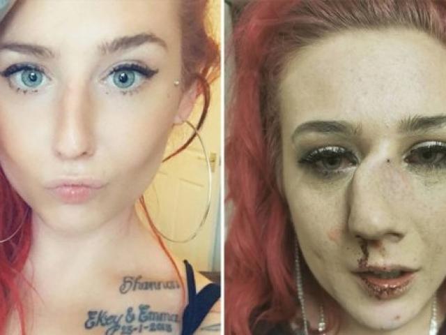 Bạn trẻ - Cuộc sống - Đang trên đường về nhà, cô gái bị kẻ lạ mặt đấm gãy mũi hãi hùng