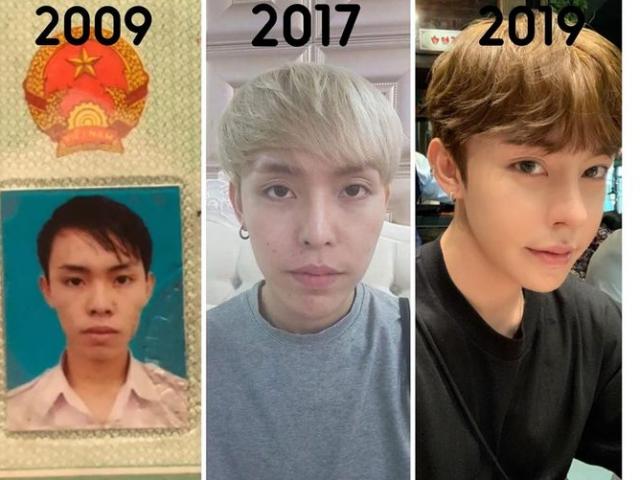 Làm đẹp - 10 năm phẫu thuật thẩm mỹ của nam sinh Đà Nẵng