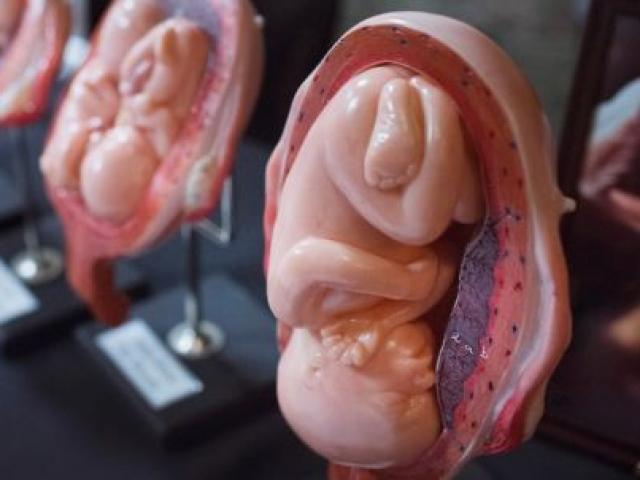 Thế giới - Mỹ: Phát hiện rợn người tại nhà bác sĩ phá thai vừa chết