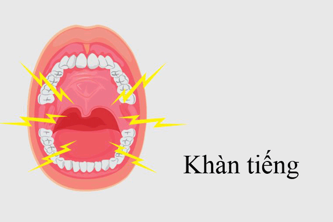 9. Khàn tiếng: Nếu bạn đột nhiên bị khàn giọng trong 2 tuần trở lên, đó có thể là dấu hiệu cho thấy ung thư miệng đang ảnh hưởng đến giọng nói của bạn.
