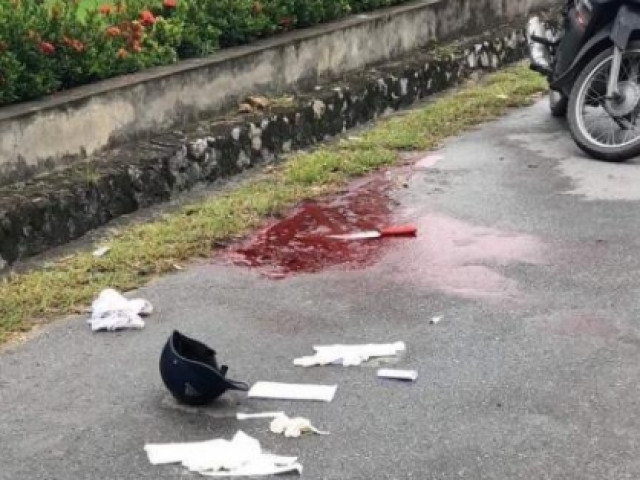 Pháp luật - Đang đi xe máy trên đường, 1 phụ nữ bất ngờ bị đâm trọng thương