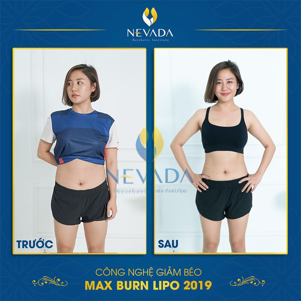 Ca sỹ Văn Mai Hương sở hữu eo thon nhờ công nghệ Max Burn Lipo