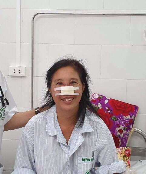 Sau hơn 3 tuần điều trị, bệnh nhân whitmore tổn thương cánh mũi đã được xuất viện.