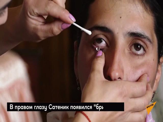 Phi thường - kỳ quặc - Video: Đôi mắt biết "sản xuất" pha lê của cô gái trẻ, mỗi ngày cho ra 50 mảnh