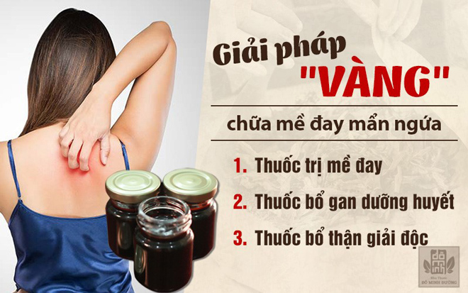 Cách trị nổi mề đay tại nhà có thực sự hiệu quả? Chuyên gia tư vấn - 4