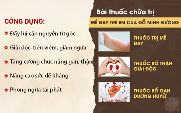 Nổi mề đay ở trẻ nhỏ và cách điều trị hết mẩn ngứa từ thảo dược tự nhiên - 4