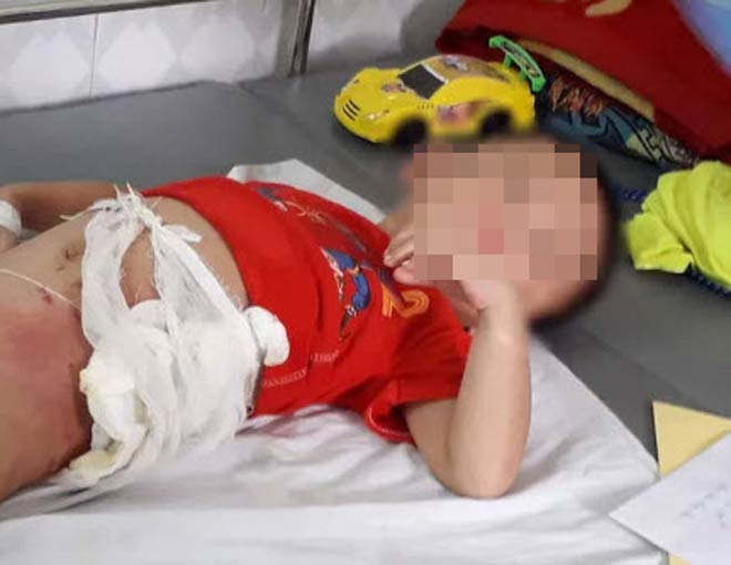 Hình ảnh cháu bé bị ném vào đống lửa tại Hòa Bình. Ảnh: TL