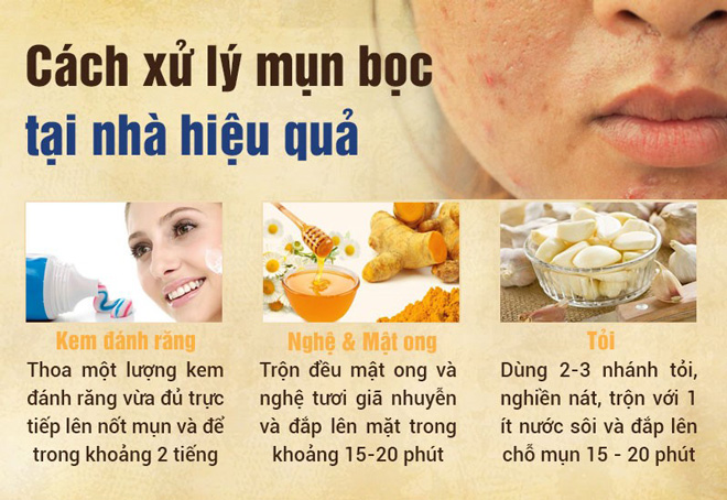 Mụn bọc và cách điều trị an toàn, hiệu quả, không để lại sẹo - 4