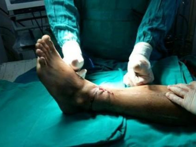 Sức khỏe đời sống - “Cậu bé” và các phần cơ thể đứt rời phải giữ gìn bằng cách này bác sĩ mới nhất định cứu được