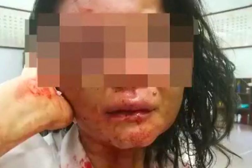 Những tín đồ của giáo phái đã bị đánh đập một cách dã man (ảnh Dailystar)
