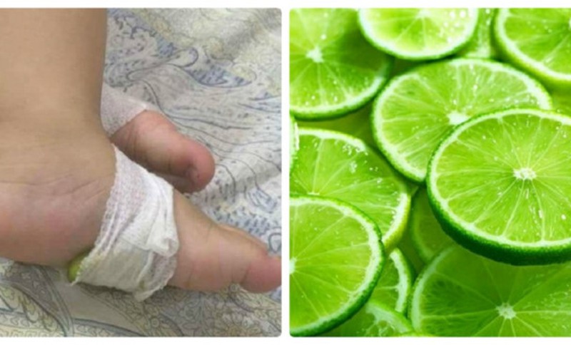Trên mạng nhiều người truyền nhau đắp chanh xắt lát vào chân bé sẽ trị được bệnh ho. Ảnh: Internet