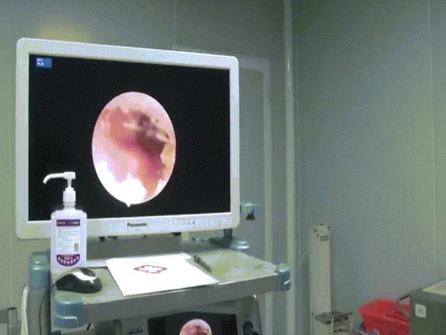 Phi thường - kỳ quặc - Video: Nghe thấy âm thanh lạ khi đang ngủ, đến gặp bác sĩ phát hiện sốc