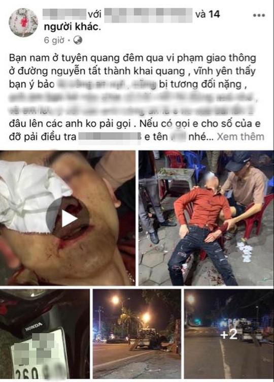 Hình ảnh nam thanh niên bị thương sau khi gặp chốt CSGT được đăng tải trên mạng xã hội