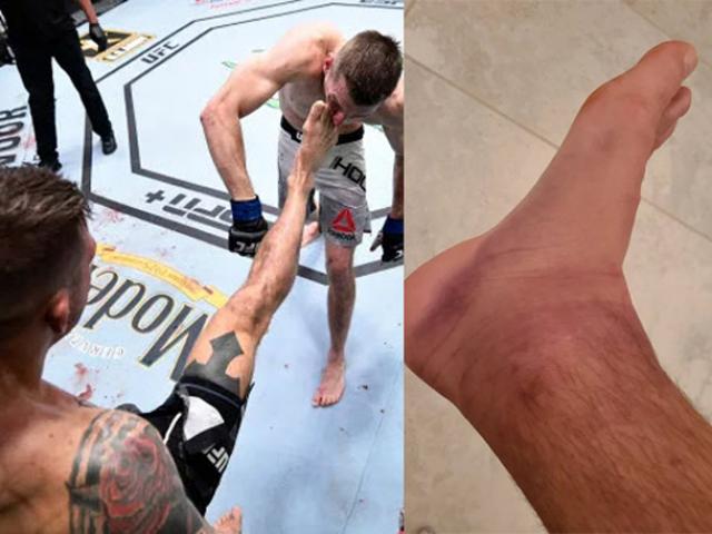 Thể thao - Võ sĩ UFC đá trúng cao thủ "mặt sắt": Chân cứng như thép cũng sưng húp