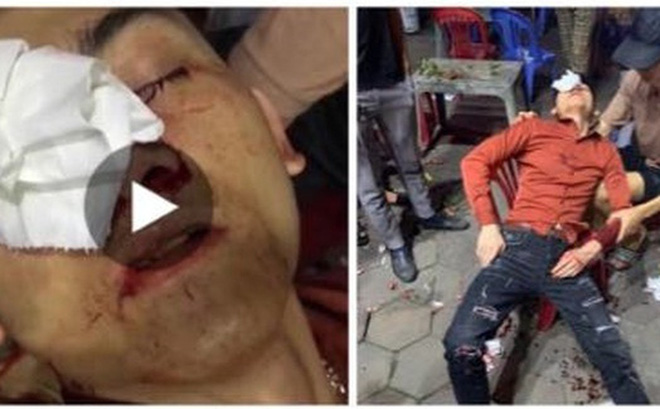  Hình ảnh nam thanh niên bị thương.