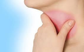 Ung thư vòm họng giai đoạn đầu dễ bị nhầm lẫn với viêm họng. Ảnh minh họa