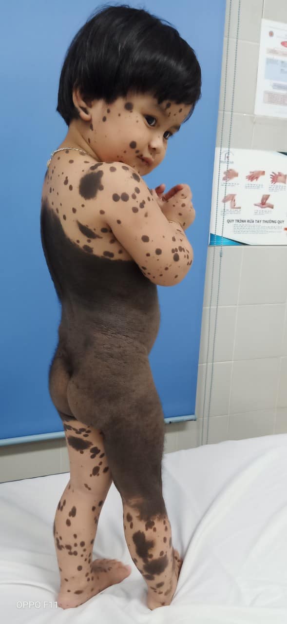 Xót xa bé gái sinh ra đã bị gọi là "con ma" - 2