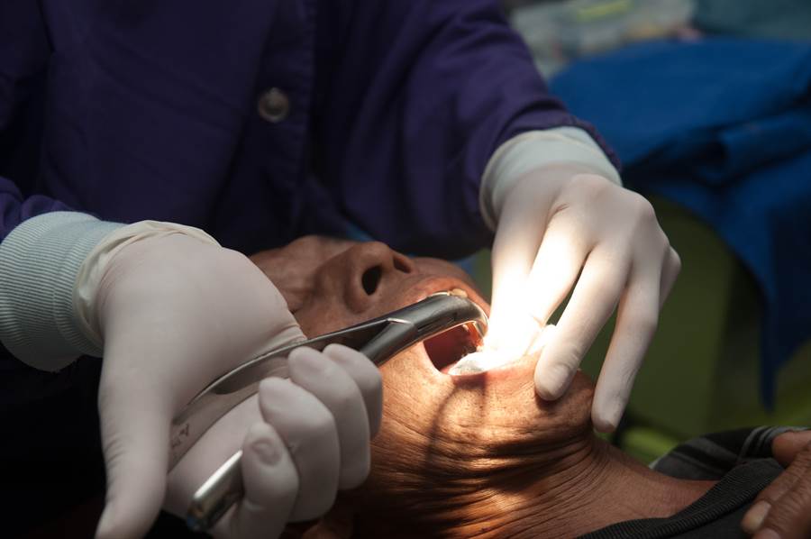 Nhổ răng khôn là một trải nghiệm đáng sợ và cũng là “ký ức đau đớn” đối với nhiều người.
