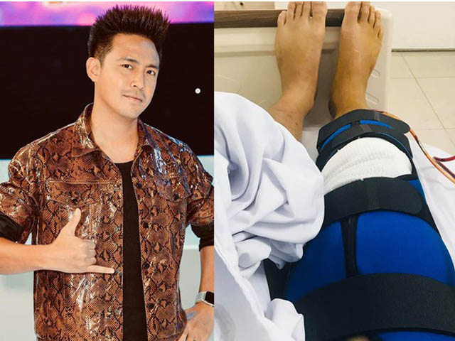 Đời sống Showbiz - Thanh Duy giờ ra sao sau vụ té cầu thang, đứt dây chằng không thể đi lại?