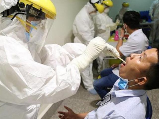 Sức khỏe đời sống - Đã có 78 ca mắc bệnh bạch hầu, nhiều trường hợp không có biểu hiện