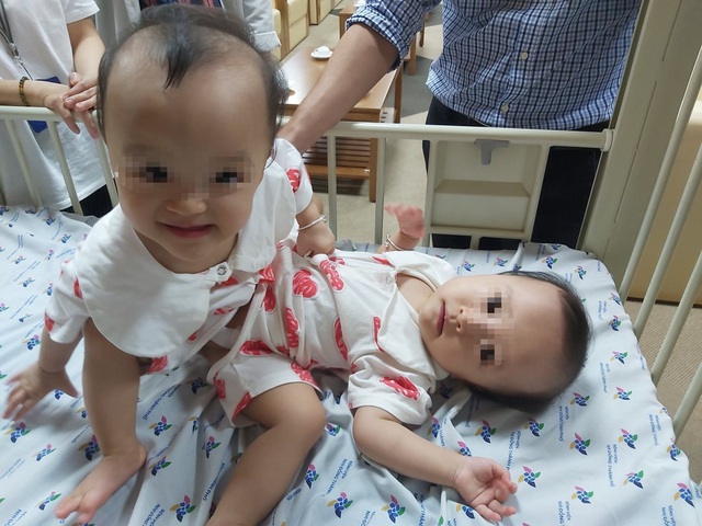 Hai bé gái đã được 13 tháng tuổi, nặng 15 kg với các chỉ số phát triển gần với những trẻ bình thường. Ảnh: BVCC.