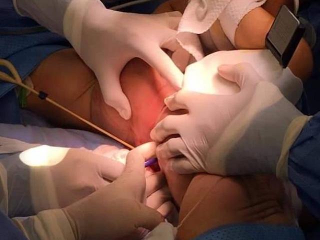 Tin tức trong ngày - Tin tức 24h qua: Phẫu thuật tách thành công cặp song sinh dính liền, BV Nhi đồng nói gì?