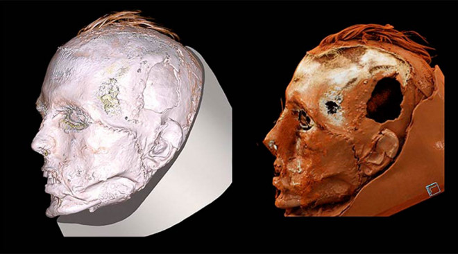 Các nhà khoa học đã tìm lại dung nhan người đàn ông đeo mặt nạ tử thần 1.700 và nhận thấy đó là một khuôn mặt bị tàn phá khủng khiếp - ảnh đồ họa từ nhóm nghiên cứu