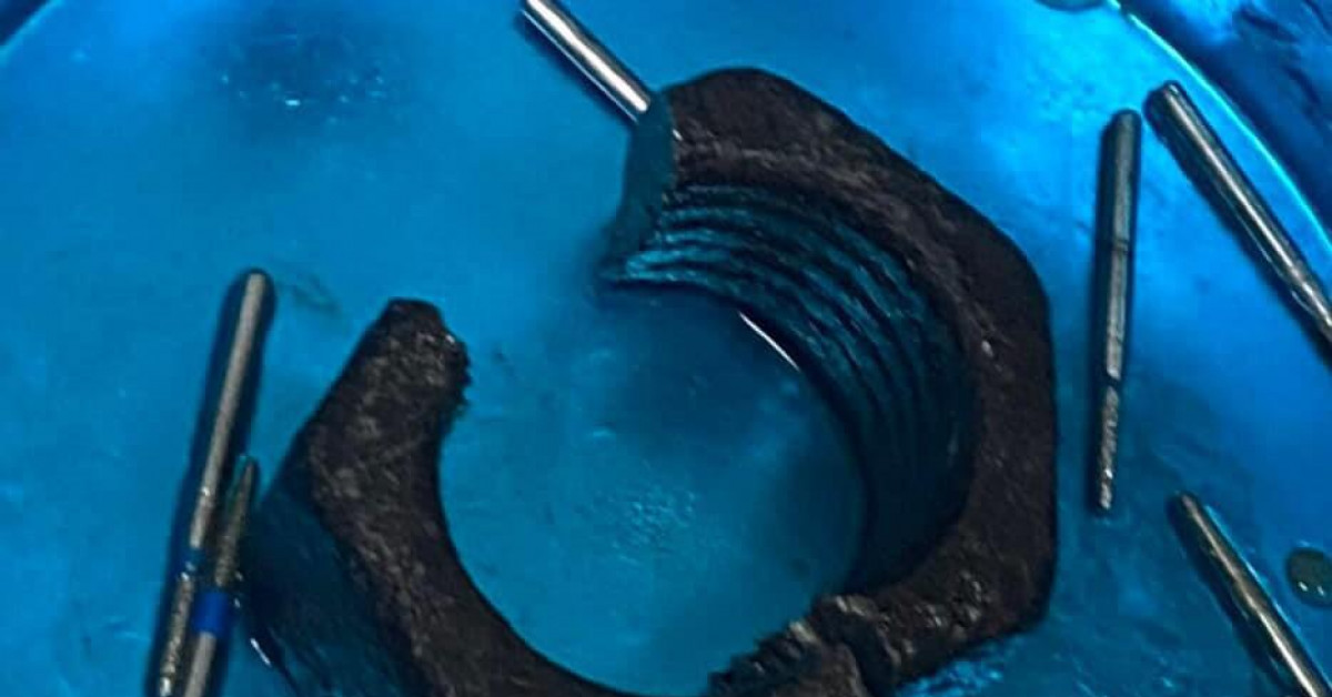 Sức khỏe đời sống - Chơi dại, nam thanh niên tự nhét ‘của quý’ vào đai ốc lục giác