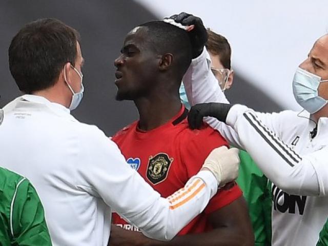 Bóng đá - Tin HOT bóng đá tối 21/7: MU đón tin vui từ chấn thương đầu của Bailly