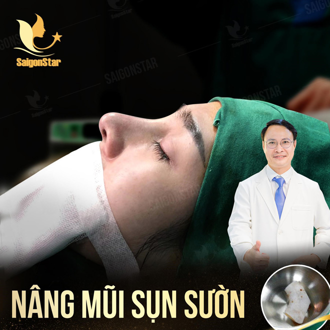 Chuyên gia thẩm mỹ Dr. Hoạt: “Nâng mũi sụn sườn là giải pháp tối ưu cho mũi hỏng” - 1