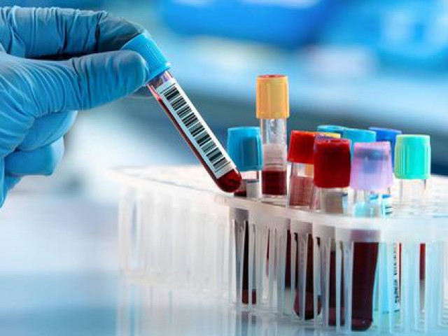 Sức khỏe đời sống - Phương pháp giá rẻ xác định 5 loại ung thư trước đến 4 năm