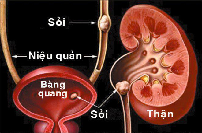 Nữ diễn viên nhập viện gấp vì thói quen không thích uống nước lọc, thường xuyên trà và cà phê để giải khát - 2