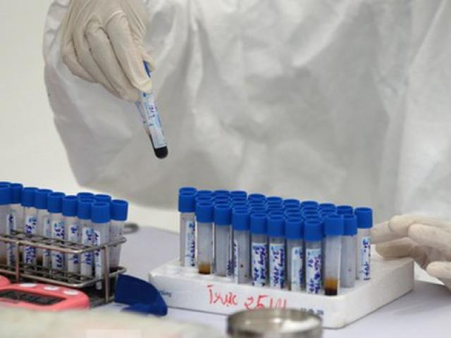 Tin tức trong ngày - Tin tức 24h qua: Việt Nam xuất hiện chủng virus gây bệnh COVID-19 mới, lây lan nhanh hơn