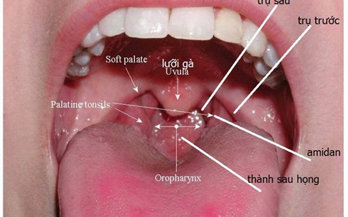 Trước và sau khi ngủ không làm điều này bạn sẽ đối diện nguy cơ ung thư dạ dày và cổ họng cực cao - 2