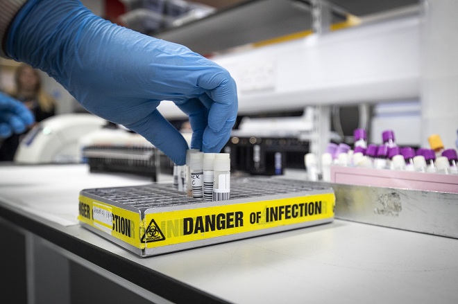 Các nhà nghiên cứu vẫn chưa tìm hiểu được rõ phản ứng của cơ thể với virus SARS-CoV-2. Ảnh minh họa.