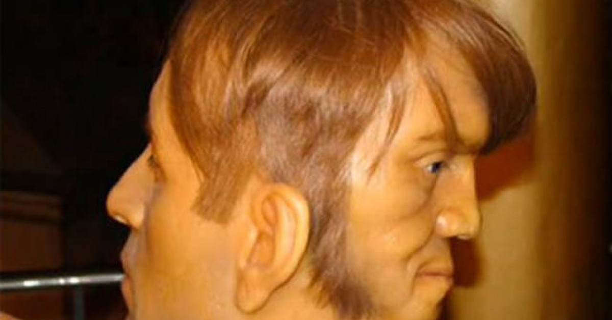 Bạn trẻ - Cuộc sống - Sự thật người đàn ông điển trai có gương mặt thứ 2 sau gáy, cứ khóc nó sẽ cười nhạo