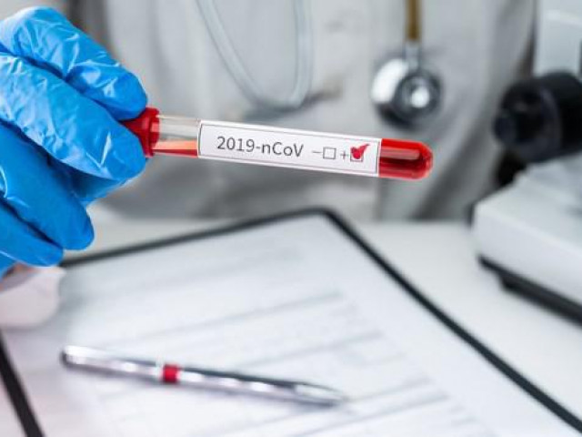 Sức khỏe đời sống - Vì sao phải gộp nhiều mẫu bệnh phẩm thành ‘nhóm’ để xét nghiệm SARS-CoV-2