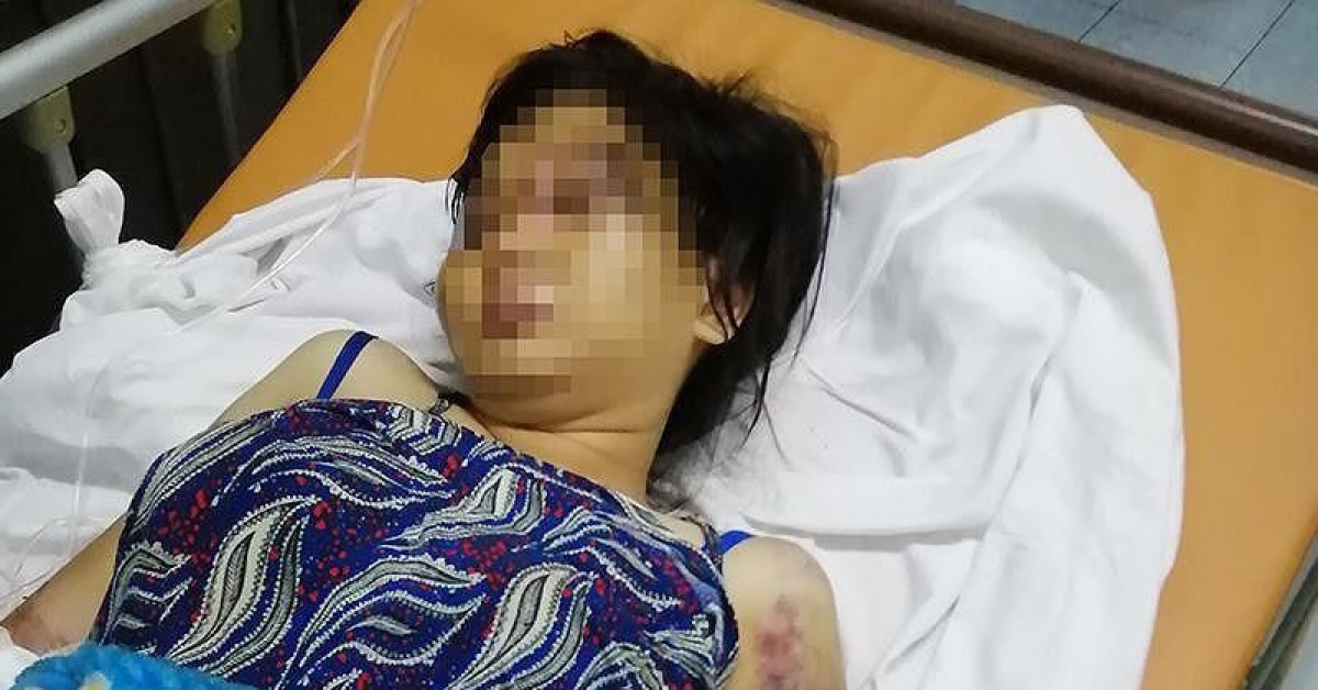 Bị hại thời điểm điều trị tại bệnh viện
