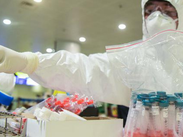 Sức khỏe đời sống - Chuyên gia nói gì về một số bệnh nhân xét nghiệm lần 3 mới phát hiện dương tính với SARS-CoV-2?