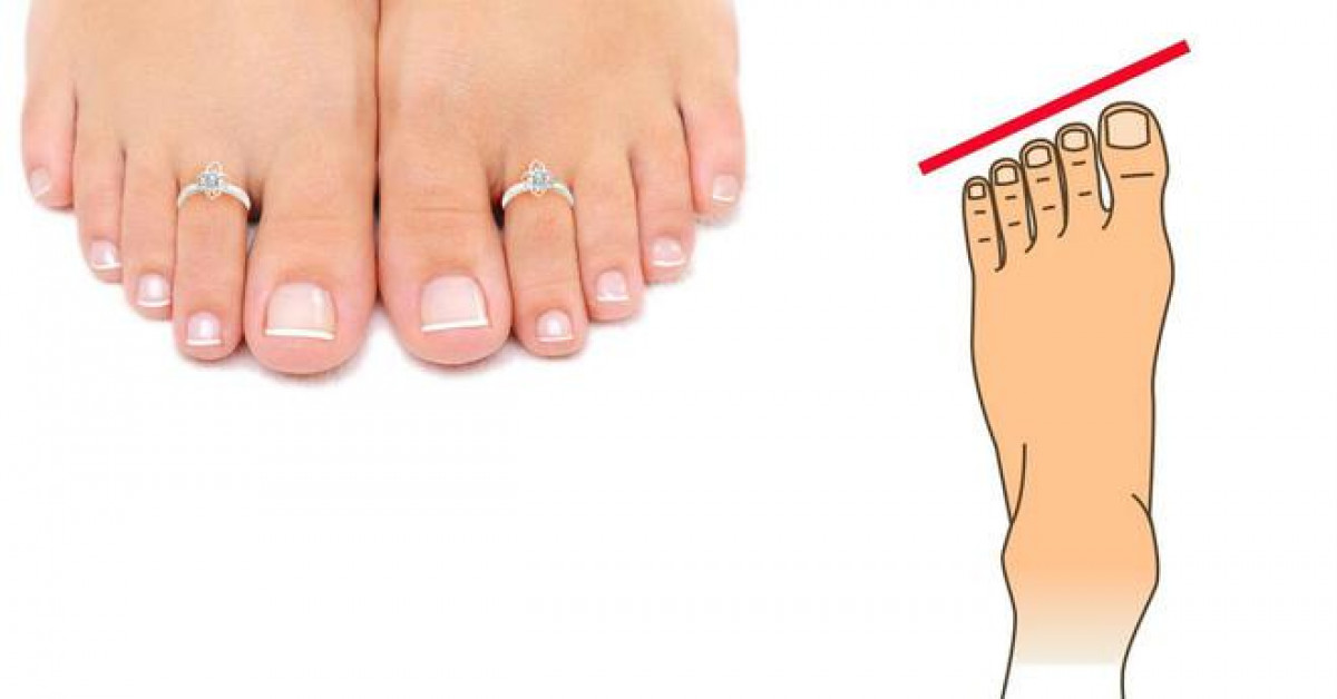 Bạn trẻ - Cuộc sống - Xem tướng bàn chân, biết ai khắc khổ, gian nan, ai giàu sang phú quý