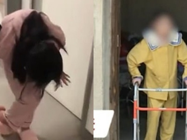 Bạn trẻ - Cuộc sống - Cuộc sống hiện tại của cô gái bị gập đôi người, ngực áp vào đùi suốt hơn 10 năm