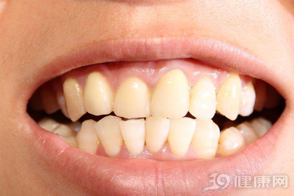 Đại học Harvard công bố kết quả nghiên cứu 20 năm về mối liên hệ giữa răng miệng và ung thư: Người có hàm răng xấu tăng nguy cơ mắc 2 bệnh ung thư - 3