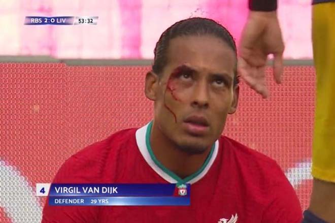 Van Dijk chấn thương ở trận giao hữu của Liverpool với RB Salzburg