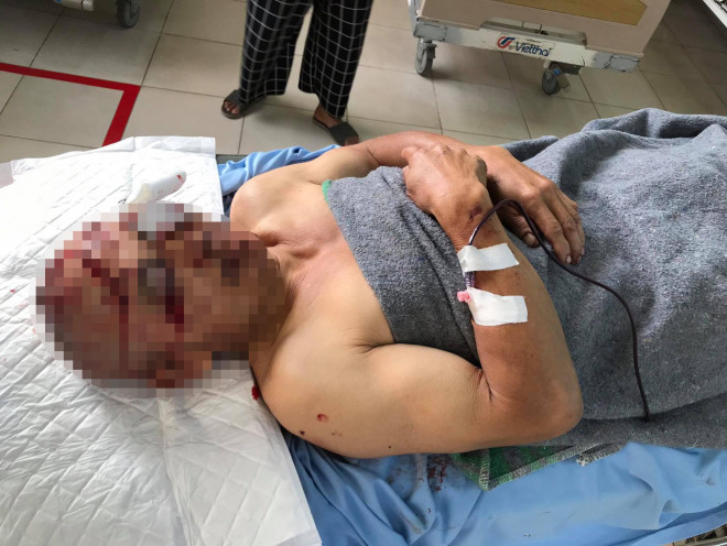 Ông Dĩnh được đưa đến Bệnh viện Đa khoa Lâm Đồng cấp cứu với nhiều vết chém ở phần đầu.