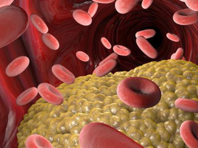 Sức khỏe đời sống - 3 lời khuyên "vàng" và 7 thực phẩm được ví như "thần dược" hạ mỡ máu, nên sớm bổ sung vào thực đơn