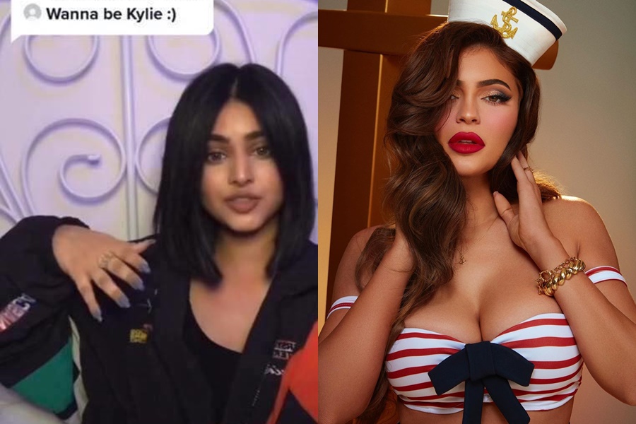 Kylie Jenner bị miệt thị vì phẫu thuật thẩm mỹ - 1