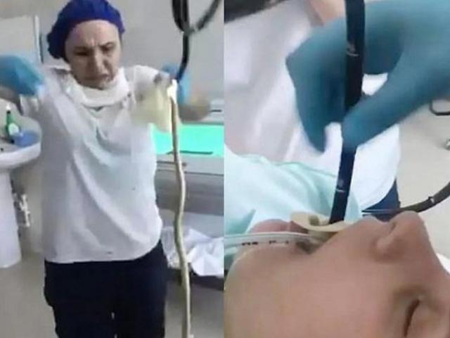 Media - Bác sĩ "phát hoảng" kéo con rắn dài 1,2 m từ cổ họng bệnh nhân